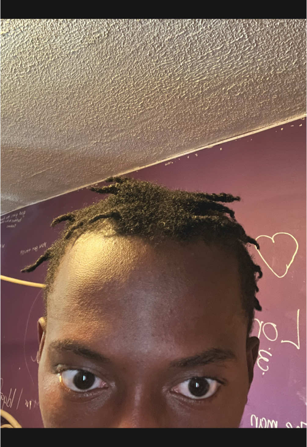 came a long way💔 #dreads #dreadjourney #starterlocs #fyp #zyxcba #viralvideo 