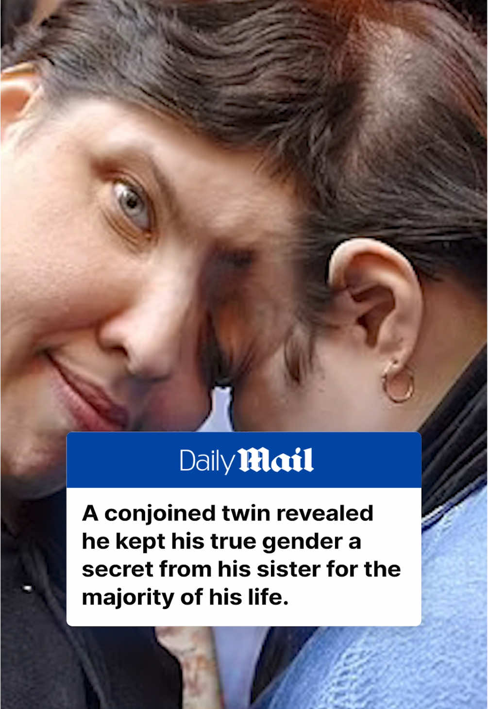 Lori and George Schappell, born in Pennsylvania in 1961, had partially-fused skulls and shared 30 per cent of their brains. Yet, despite being attached at the head, George had harbored a secret from his sister for most of their lives. George, formerly Dori, was assigned female at birth and later came out as a transgender man in 2007. Read full story on DailyMail.com. Link in bio. 📷 Getty / Shutterstock #twins #worldrecord #conjoinedtwins #news