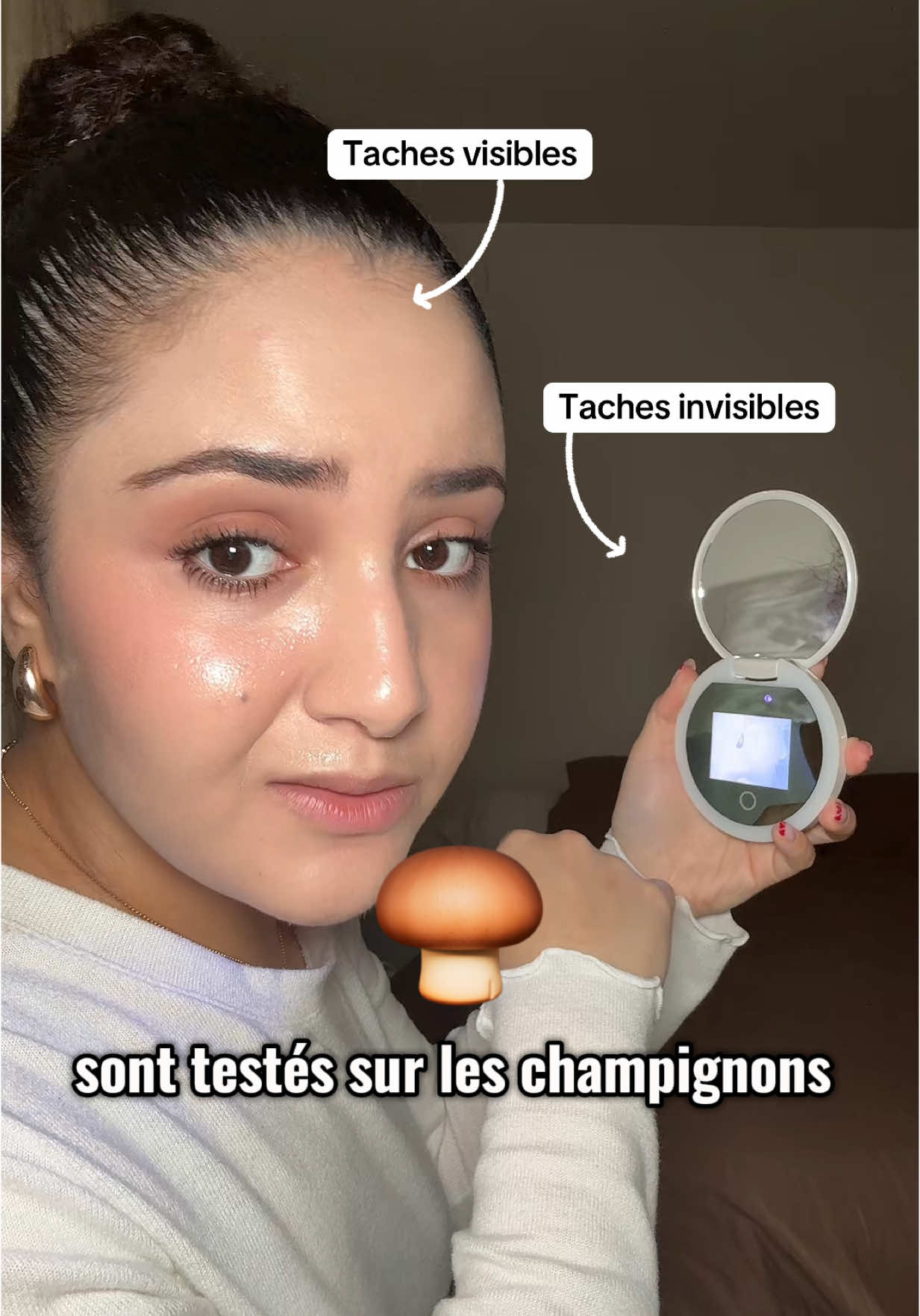 Publicité | Les taches brunes font partie des préoccupations skincare les plus difficiles ! Je sais à quel point ça peut être frustrant… Qu’elles viennent du soleil, d’ imperfections ou simplement du temps qui passe on a toujours tendance à penser qu’elles sont impossibles à faire disparaître ! Sauf qu’il suffit juste de se renseigner pour comprendre le mécanisme de la peau et les solutions adaptées à la peau humaine 😉 Le secret, c’est d’agir directement à la source en régulant la production de mélanine (enzyme Tyrosinase). Et c’est exactement ce que fait le Thiamidol ! Il cible les taches brunes visibles et invisibles en bloquant la tyrosinase ce qui permet d’éviter aussi leur retour ! En 2 semaines minimum et avec 4 doses de Thiamidol par jour tu pourras constater les premiers résultats : la peau est plus lumineuse, le teint plus uniforme et éclatant. Produit mentionné : Sérum DUO Anti-Pigment de #eucerin  #soindelapeau #tachesbrunes #hyperpigmentation #melasma #antitaches #camarche #thiamidol #antitachespourtous… #cestprouvé #conseilbeaute 