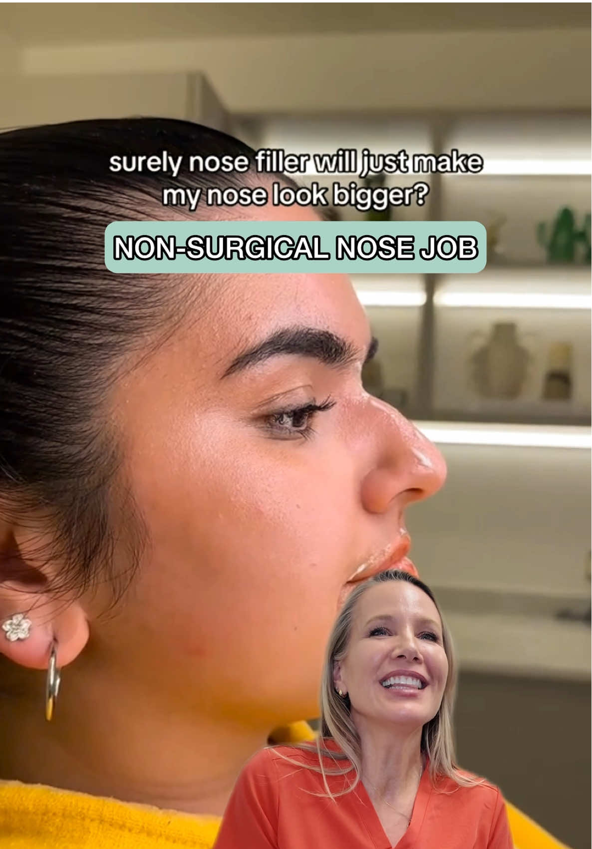 Non-surgical nose job. Is it possible to get the look you are after without surgery? Here’s our nurse Lorrie with the answers! @Ministry of Faces  #nonsurgicalrhinoplasty #plasticsurgeonsoftiktok #doctorsoftiktok #nursesoftiktok 