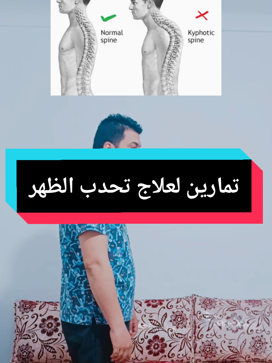 تعاني من تحدب أسفل الرقبة او حدبة الجاموس !!؟؟ #تحدب_الرقبه #إعوجاج_العمود_الفقرى #علاج #علاج_طبيعي #physiotherapy 