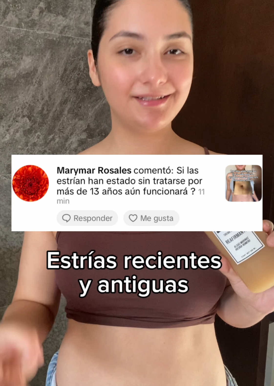 desvanece estrías recientes y antiguas crema para estrías #estrias #estrias #estriasantiguas #estriasblancas #estriasrojas #estrias