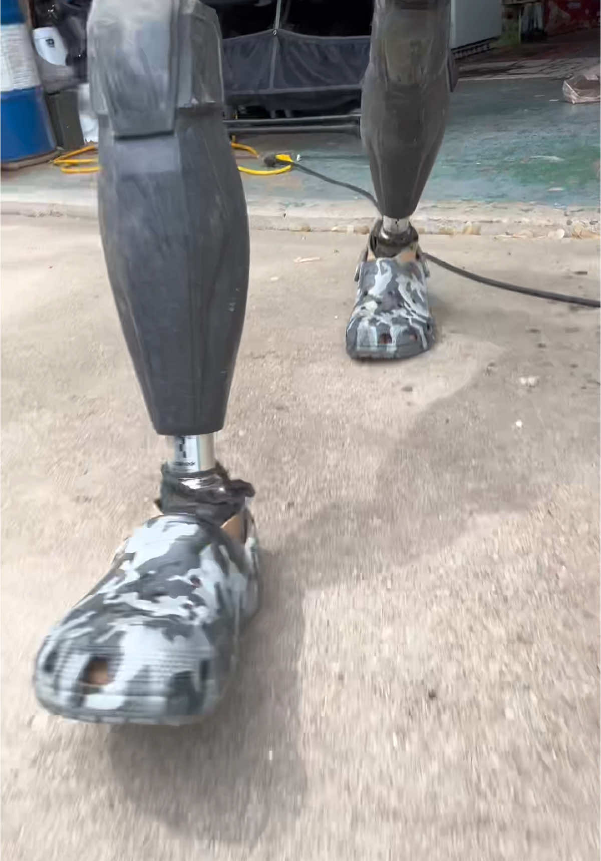 Bout croc season!! #limblossboss #dreamteamprosthetics #myleglesslife #amputee #shortking #amputeelife #funny #crocs #crocs4life #crocsad #crocswithnosocs #epic #prosthetic #sundayfunday #cool #awesome 