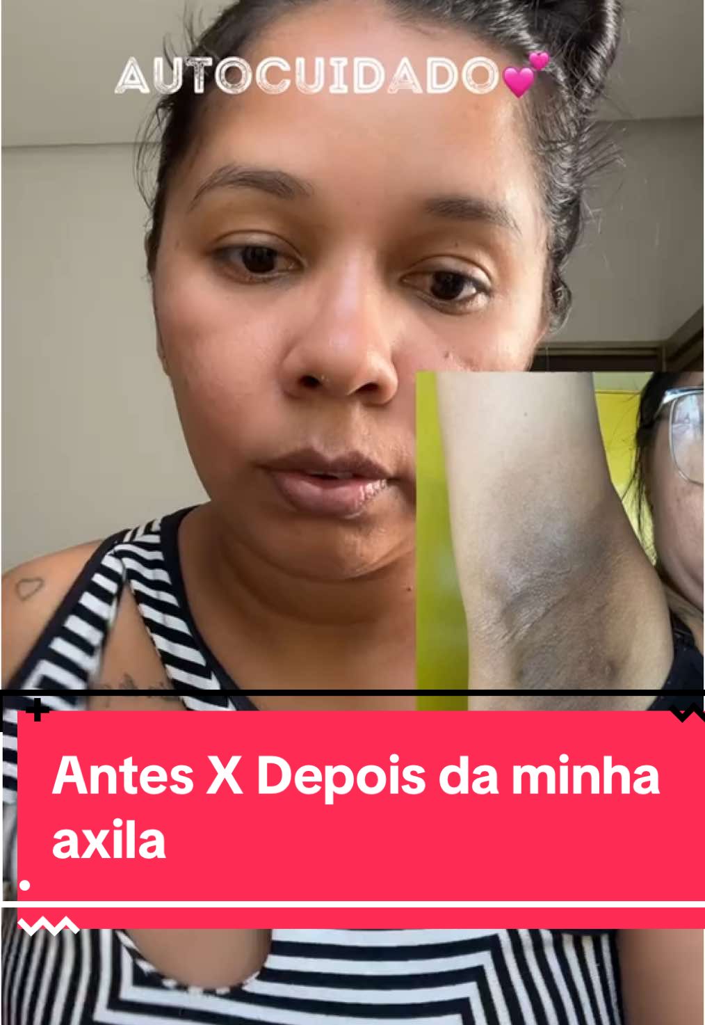 #autocuidado #gravidez #posparto #axilasoscuras 