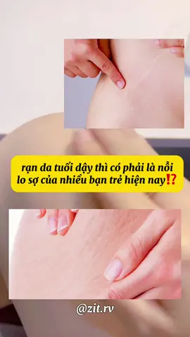 #randa #nutda ##randatuoidaythi #kemrandaovelaabera #ovelaabera #ovela #abera #unbox #rv #xh #vr #xuhuong 