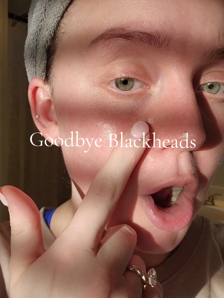Pleasantly surprised by how well this actually worked  #blackheads #koreanskincare #cleanskin  #skincare 