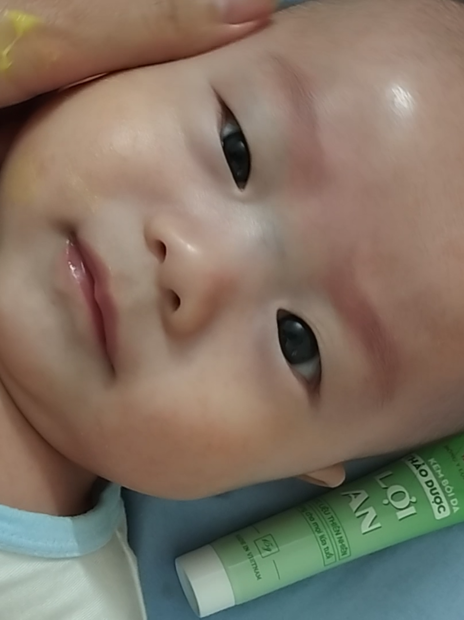 trộm vía ngày 4 bôi kem nhà lợi an nek có 