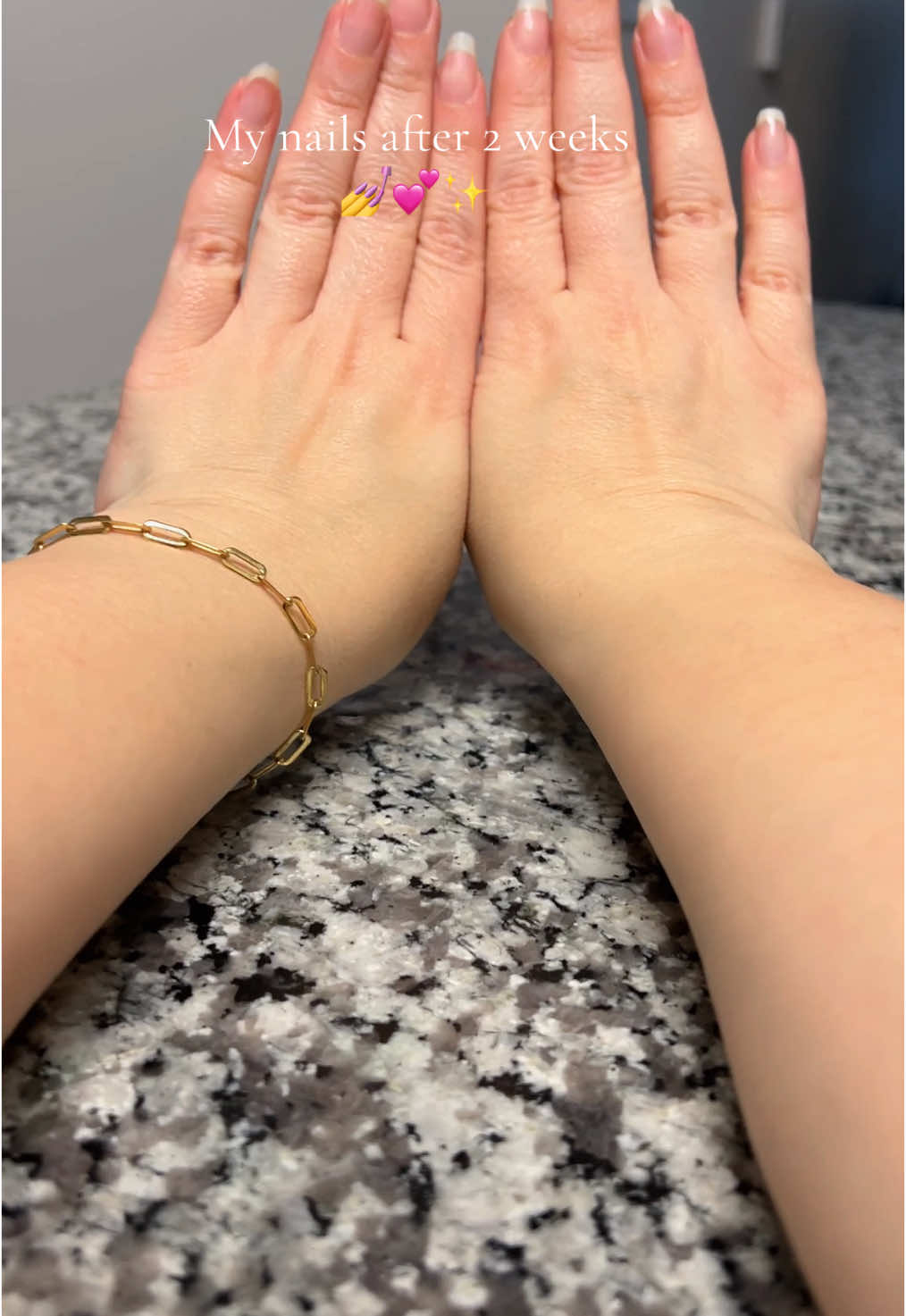 I’ve been taking these vitamins for my skin but I noticed my nails have been growing stronger and faster!! #nailgrowth #nailgrowthjourney #supplements #beautyhacks #realnails #naturalnails #nails 