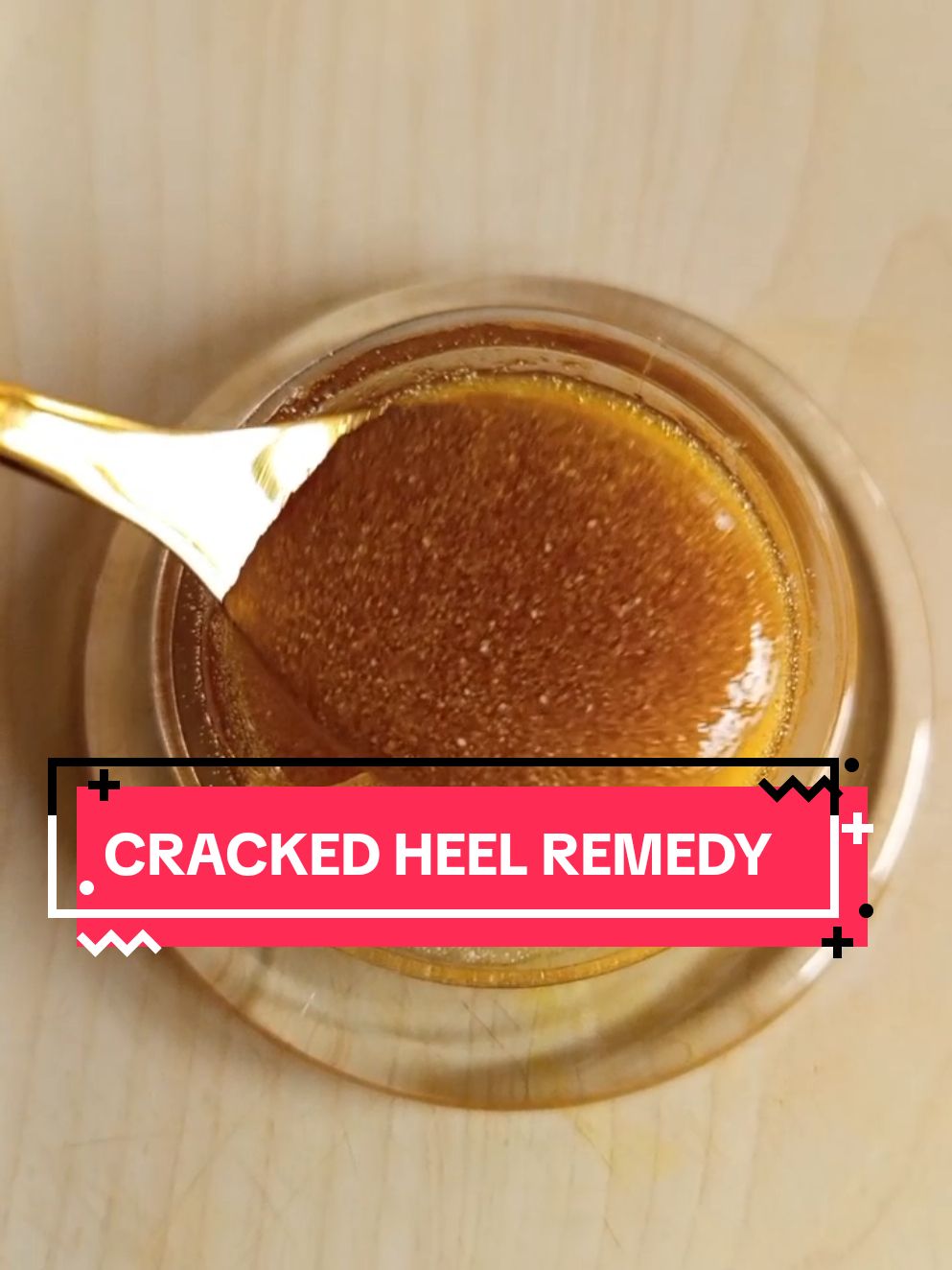 How to treat cracked heels. Remedy for cracked heels. #skincare #crackedheels #pedicures #feetcare #crackedheelsremoval #NaturalRemedies #naturalrecipes 