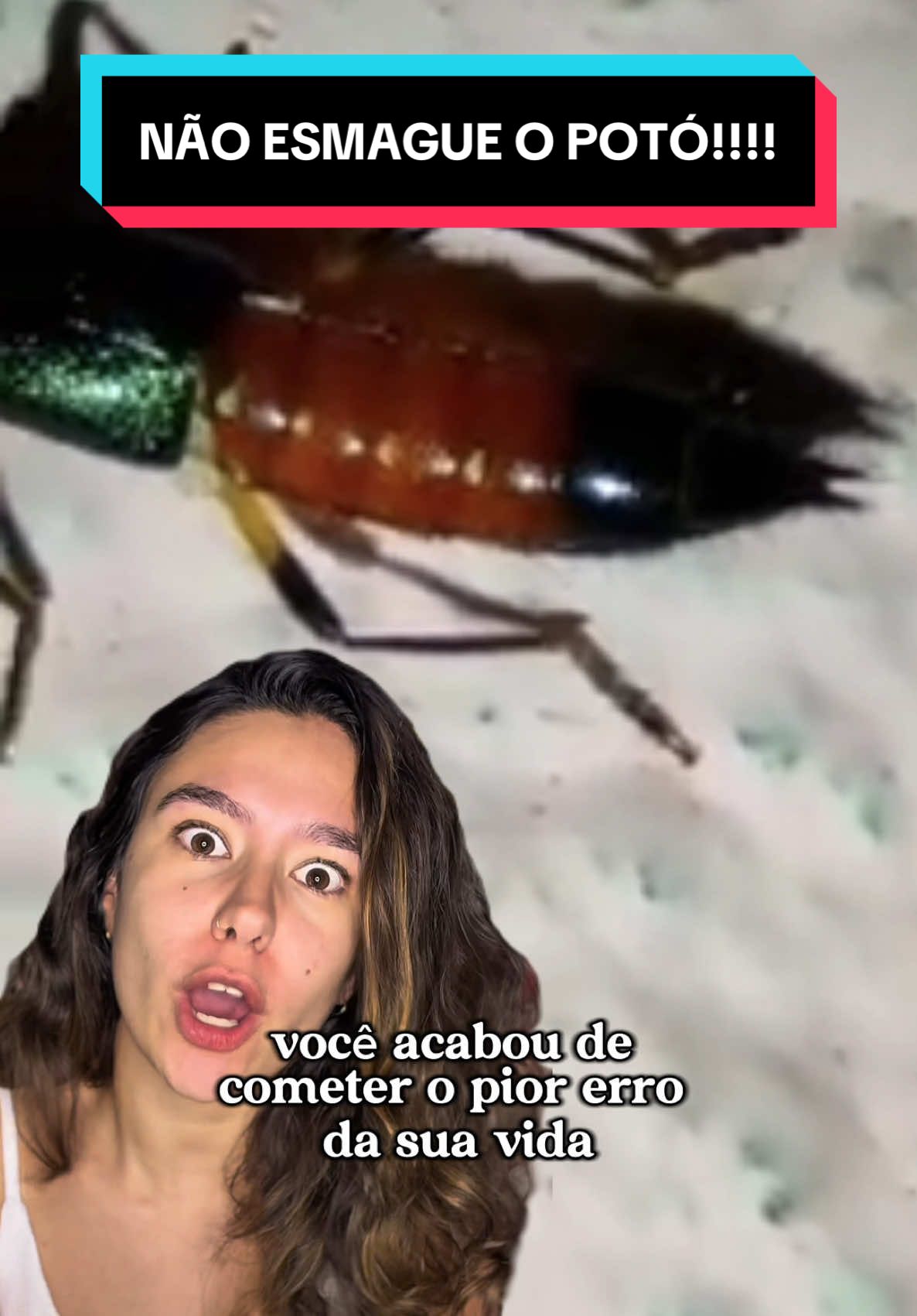 o PIOR erro da sua vida é esmagar ou bater no potó 😵 um quadro clássico é vermelhidão, coceira, bolhas, sensibilidade ao toque e pequenas feridas. mas a pessoa pode apresentar um quadro grave, com febre, dor de cabeça, dor nas juntas e até vômitos. caso esse acidente aconteça, busque atendimento médico. não vai achar que mijar em cima do machucado vai ajudar não, pelo amor de deus!!!!!!  refs.: Paederus Dermatitis: A Case Series - Srihari S, Kombettu AP, Rudrappa KG, Betkerur J. - Indian Dermatology Online Journal - 2017 - DOI: 10.4103/idoj.IDOJ_238_16 Francinaldo Soares Silva - Os potós (besouros vesicantes): biologia, ecologia e importância médica - 2015.