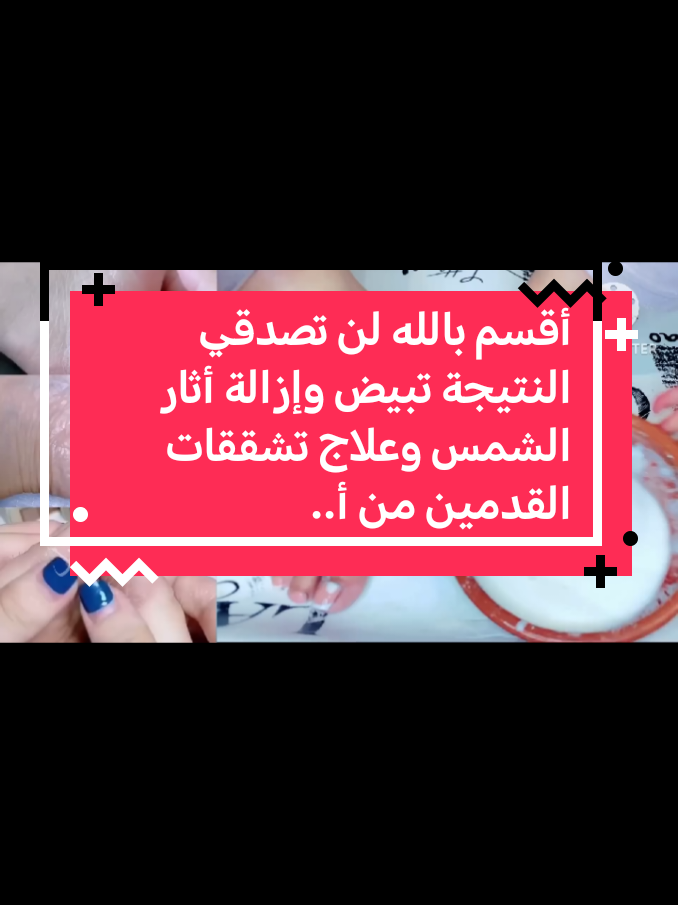 أقسم بالله لن تصدقي النتيجة تبيض وإزالة أثار الشمس وعلاج تشققات القدمين من أ...#اكسبلور #متابعه #تفاعلكم #لايكات #الشعب_الصيني_ماله_حل😂😂 #اسبانيا🇪🇸_ايطاليا🇮🇹_البرتغال🇵🇹 #فرنسا🇨🇵_بلجيكا🇧🇪_المانيا🇩🇪_اسبانيا🇪🇸 #مصر_السعوديه_العراق_فلسطين #المغرب🇲🇦تونس🇹🇳الجزائر🇩🇿 #سوريا_تركيا_العراق_السعودية_الكويت 