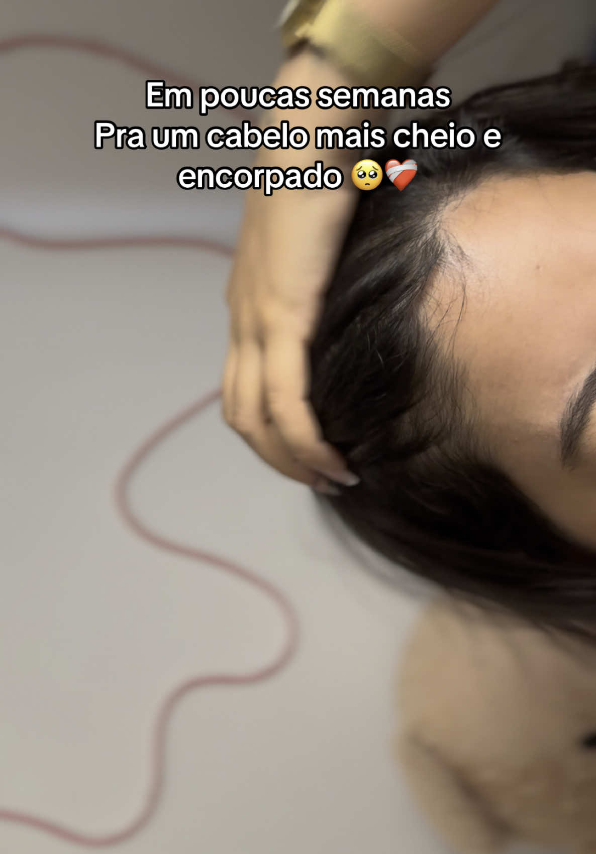 ❤️‍🩹🥺 @Bio Extratus #antiqueda #quedadecabelo #yberaparis  