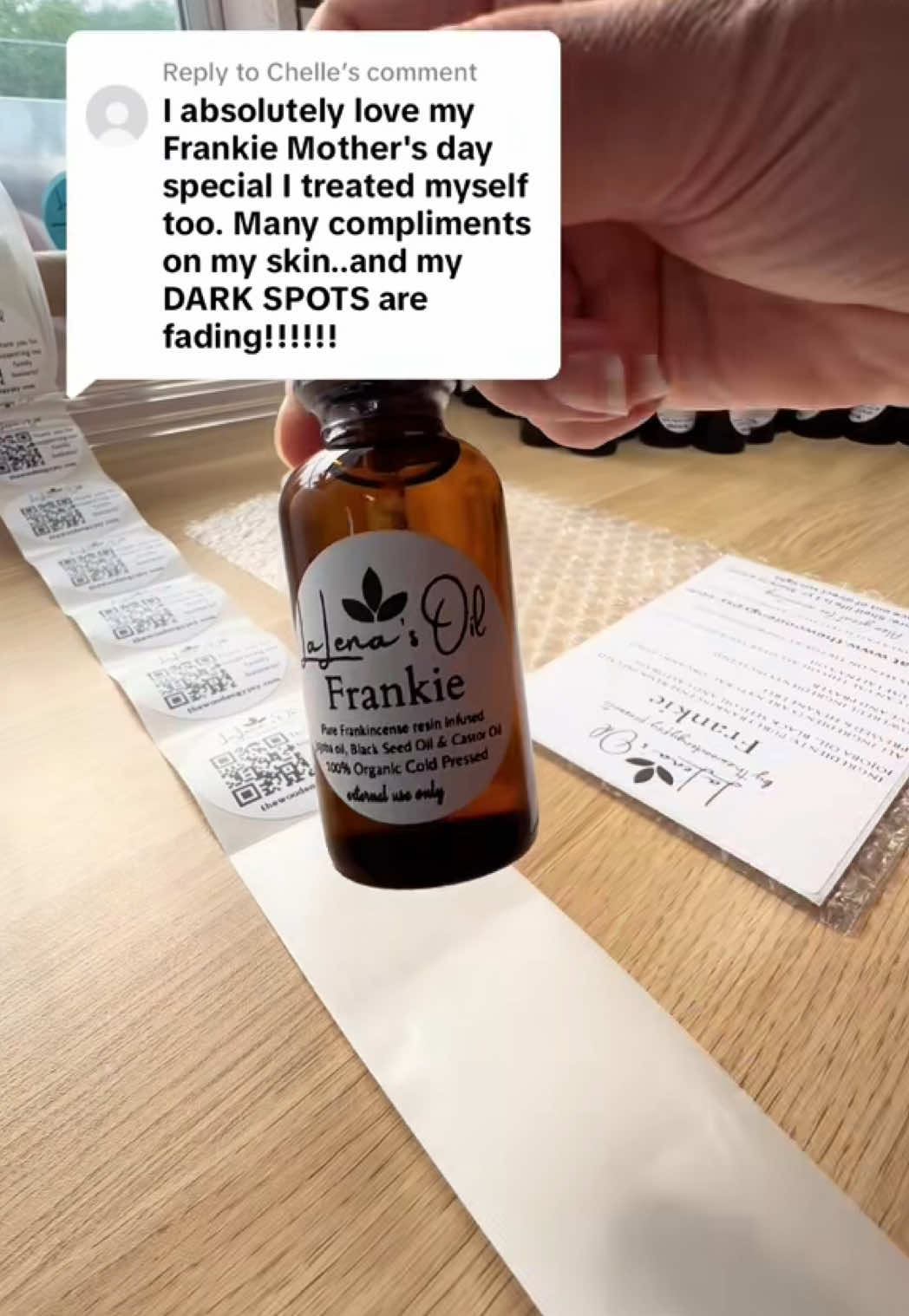 #repost Frankie Oil works to make dark spots disappear! | LaLena’s Oil by thewoodengypsy | #thewoodengypsy #lalenasoil #SmallBusiness #familybusiness #bodyoil #darkspots 