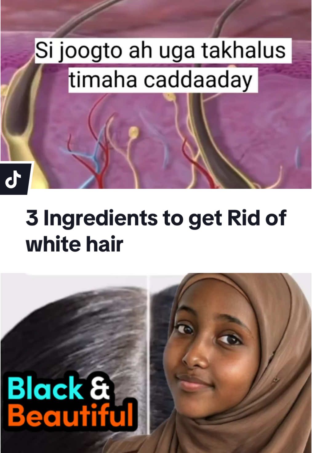 Sii joogto ah uga takhalus tiimaha caddaaday #Ramadan2025 #natural #fyb #foryou #naturalremedy #somalitiktok #fypシ゚ #health #DIY #hair #greyhair 