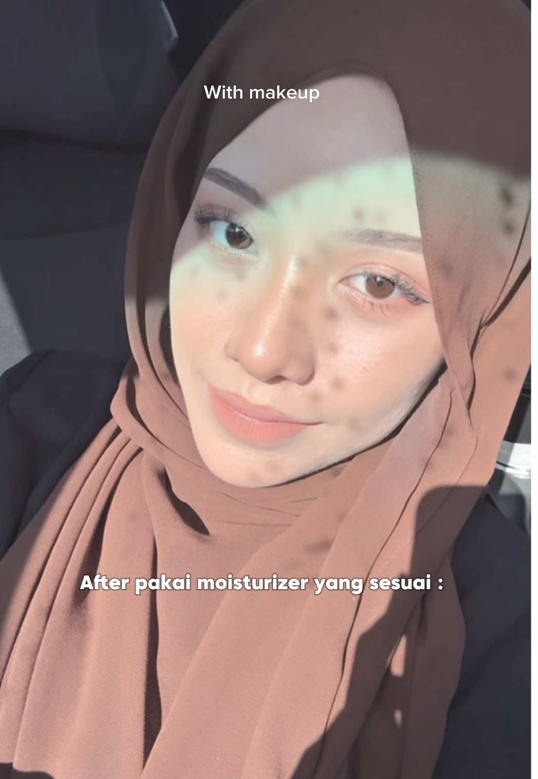 SIAPA YANG KATA TAK PERNAH BREAKOUT TU 🥹  Forever with @The Bright HQ 🩷#thebright #glowingskin