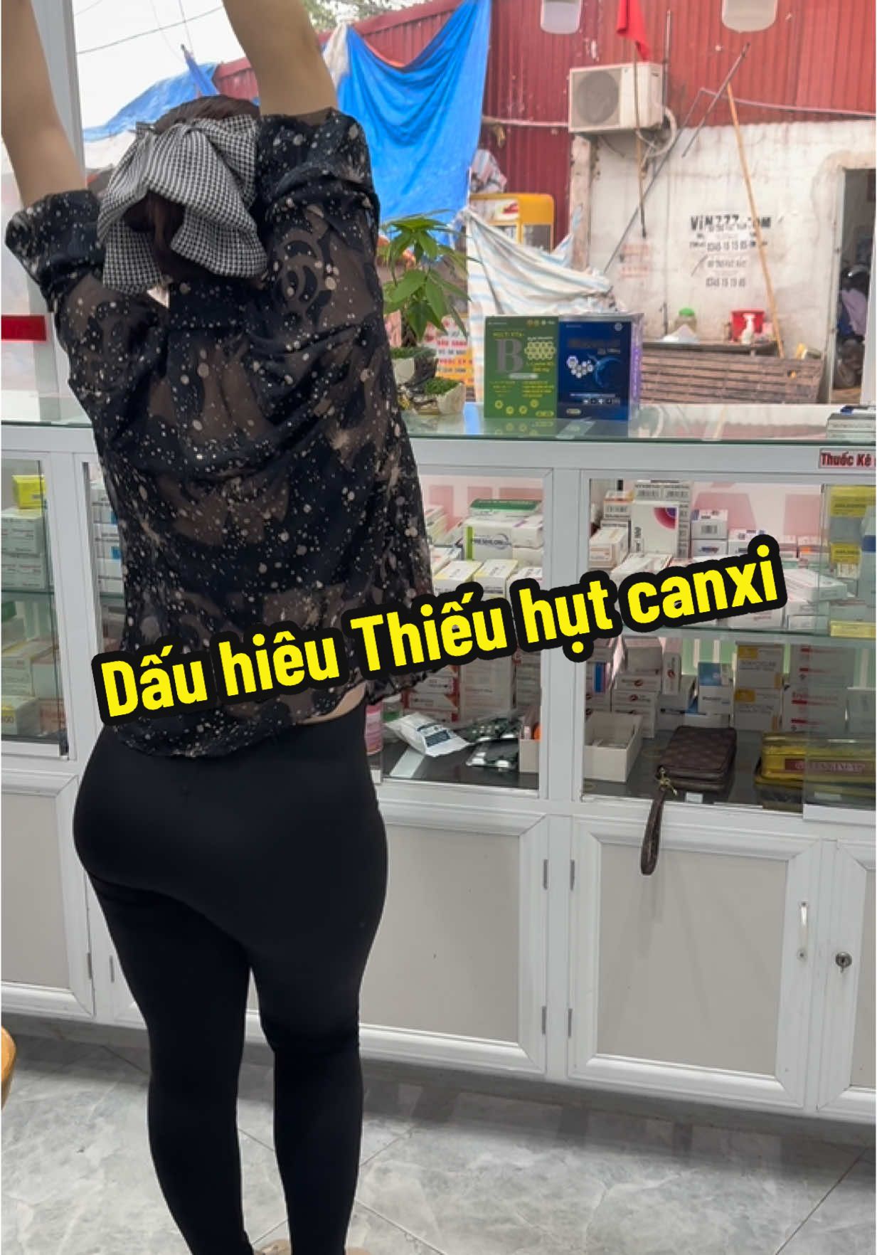 #huekoi #canxi #canxid3 #canxitaobien Dấu hiêu Thiếu hụt canxi