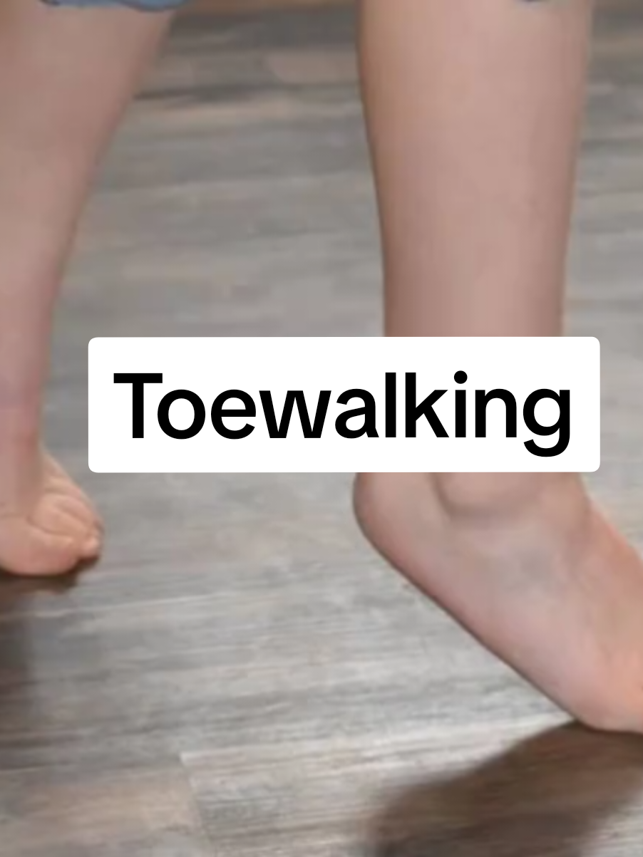 #mafischildrensclinic #toewalking #pediatrics #childcare #childhealth #doctorsadvice #parentingtips #viral_video #goviral #fypシ゚ 