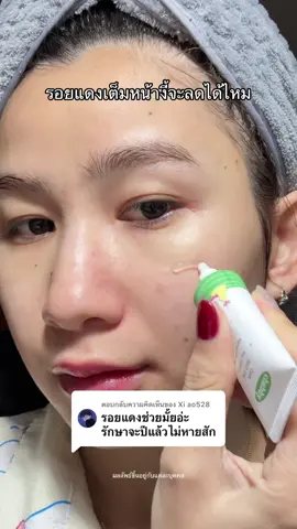 ตอบกลับ @Xi ao528 แดงทั้งแก้มทั้งคางแบบนี้จะเอาอยู่ไหมมาดูกันน😩 #รีวิวบิวตี้ #เรื่องผิว #เจลลดรอยสิวชับบี้ #ชับบี้ 