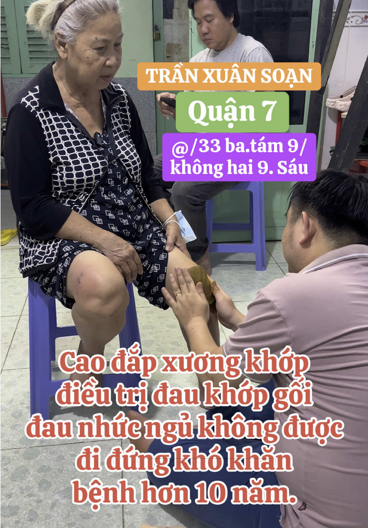 Cao đắp xương khớp đắp đau khớp gối tràn dịch khớp gối cho cô bị 10 năm đau nhức ảnh hưởng đến giấc ngủ, đi đứng khó khăn, điều trị và đắp thuốc vài tuần đã có kết quả tốt. #yhcthuynhngocphuoc #caodapxuongkhophuynhngocphuoc #daukhopgoi #gaikhopgoi #trandichkhopgoi 