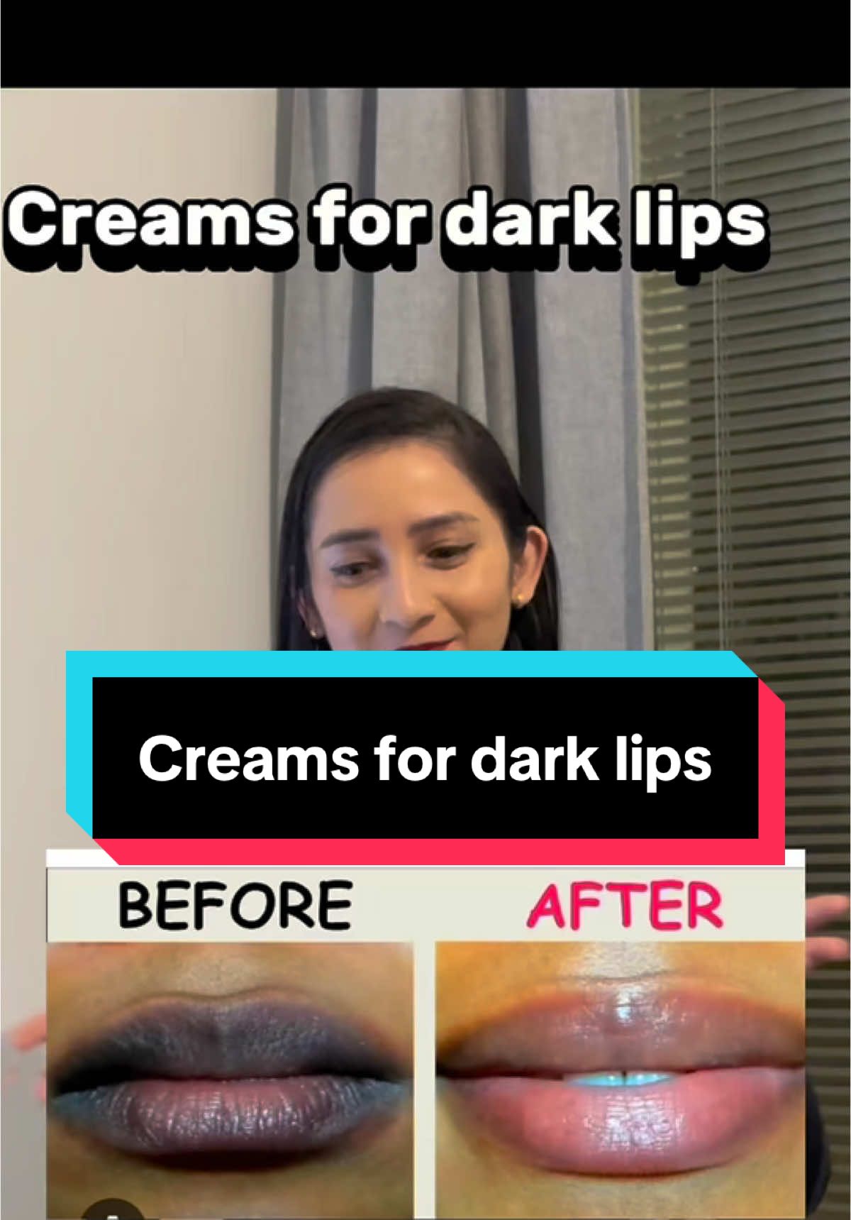 Creams for dark lips #darklips #makeup #lipbalm #antiaging #skincare #lipcream #darklipstreatment #drylips #beautiful ...#healthyskin #presuskincare #chitwan_muser 