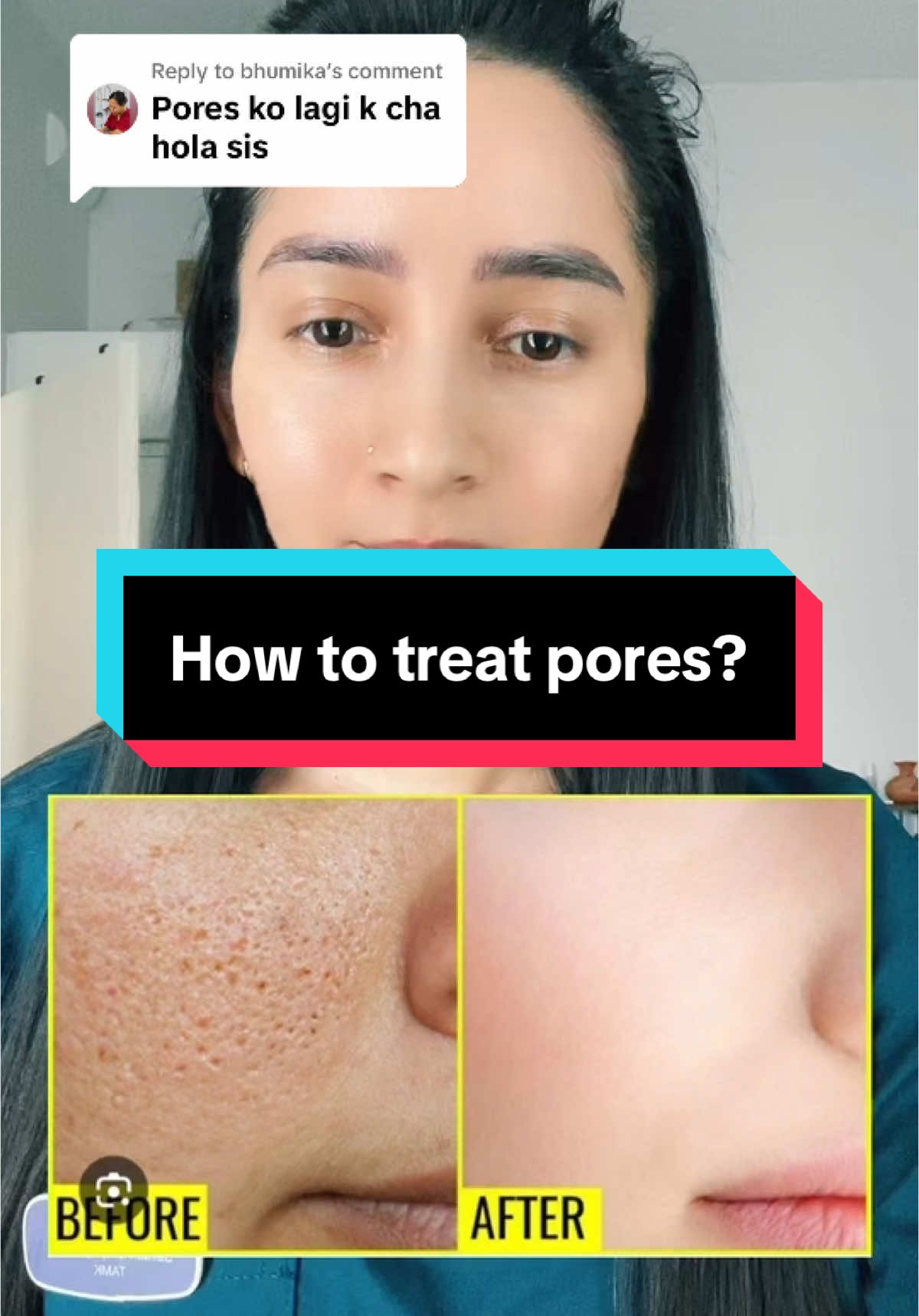 Replying to @bhumika for pores#skincare #pores #healthyskin #presuskincare #chitwan_muser #acne #skincareroutine 