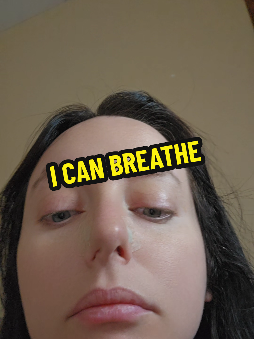 Replying to @missnemesis18 I CAN BREATHE #breathing #deviatedseptum #nasalstrip 