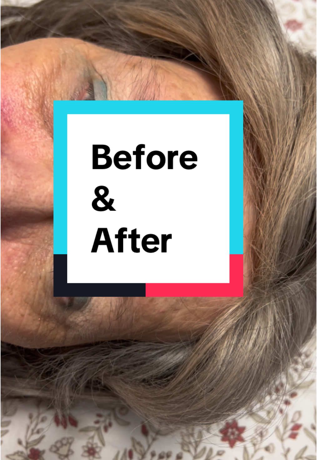 WOW! ✨ My beautiful 78-year-old client just had her brows shaped for the FIRST time, and the results are stunning! Proof that confidence and beauty have no age. 💖🔥 #BrowsOnPoint #TimelessBeauty #BeforeAndAfter #78AndFabulous #nevertoolate 