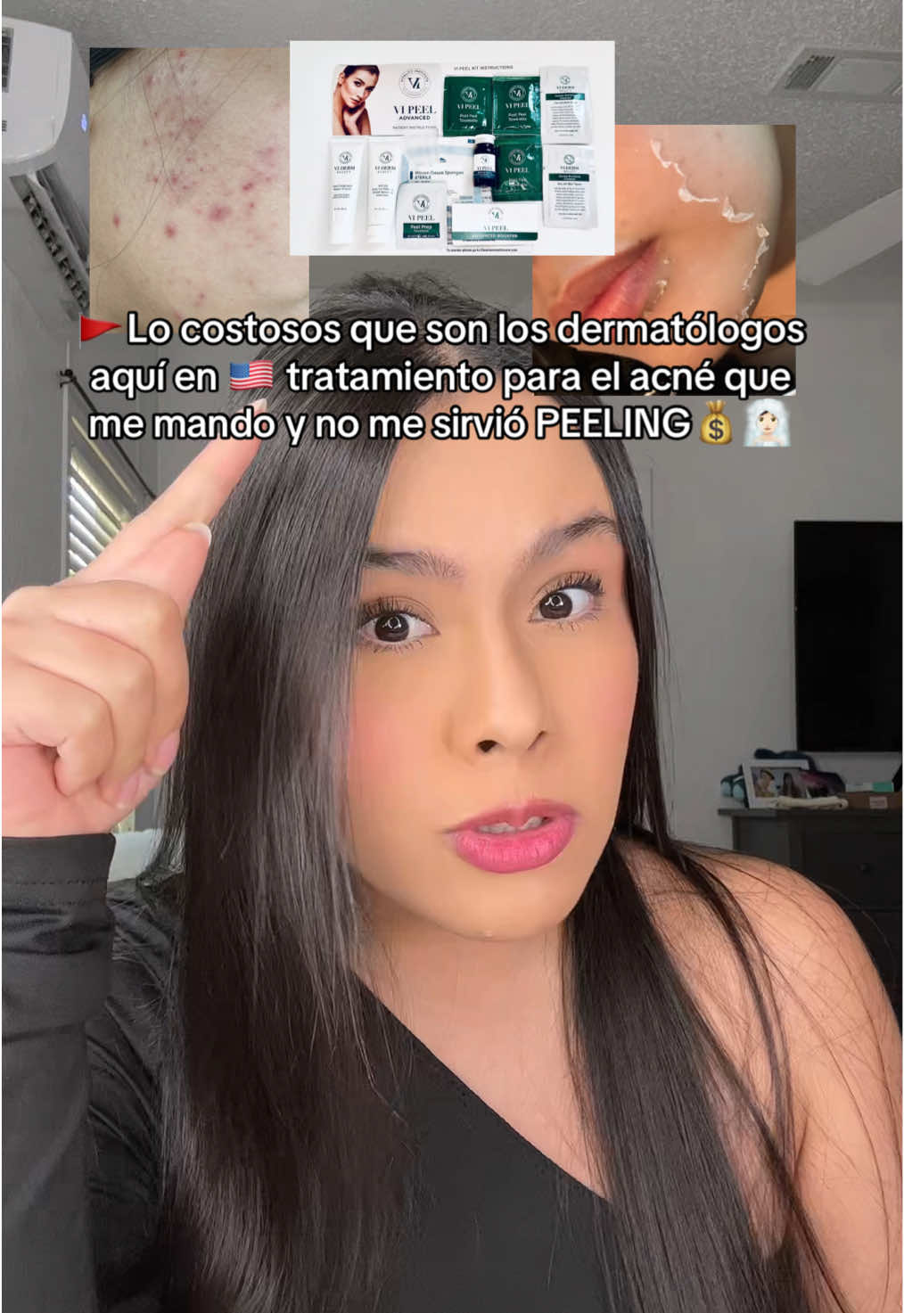 Lo costosos qué son los dermatólogos aquí en🇺🇸 tratamiento para el acné que me mandó y no me sirvió PEELING🚩🧖🏻‍♀️💰 #acne #acneskin #acnescars #acneproneskin #acneskincare #acnetips #acnepeel #estadosunidos #newyork #atlanta #california #texas #latinacontentcreator 