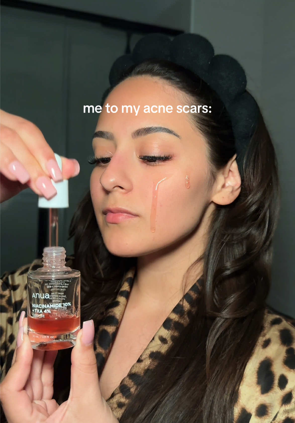 THE BEFORE AND AFTER GOES CRAZY!! 😭🙏🏻 God bless niacinamide for clearing my dark spots #anuaskincare #anuaserum #skincareroutine #hyperpigmentation #acneskin 