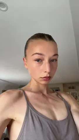 freckles 