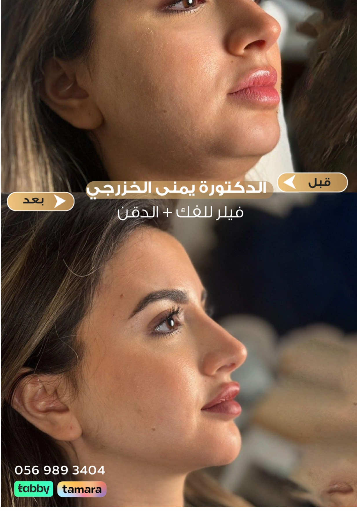 #عيادات_لافيرا_الملقا #الدكتورة_يمنى_الخزرجي 
