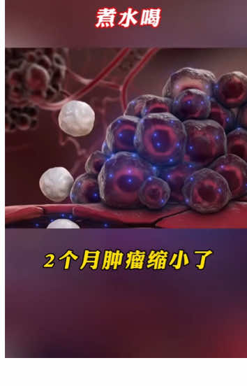 #中医 #中药 #tcm #内容过于真实 #肿瘤 #癌症 #癌 #史立人 