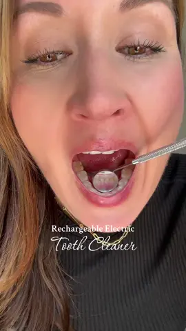 Just over here playing dentist! #tooth #teethtok #teethcare #teethcleaning #tiktokmademedoit #tiktokmademebuylt 