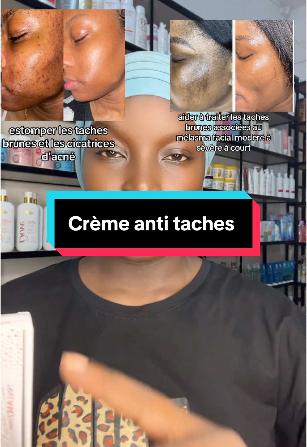 estomper les taches brunes et les cicatrices d'acné#pourtoii #GlowUp #skincareviral 