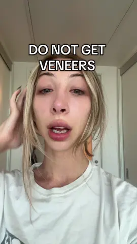 Can’t wait to live a normal life again. Thank you @International Dental Clinic for not only withholding my documents from me but DESTROYING my mouth. 💘✨ #veneers #miami #fyp #viralvideo 