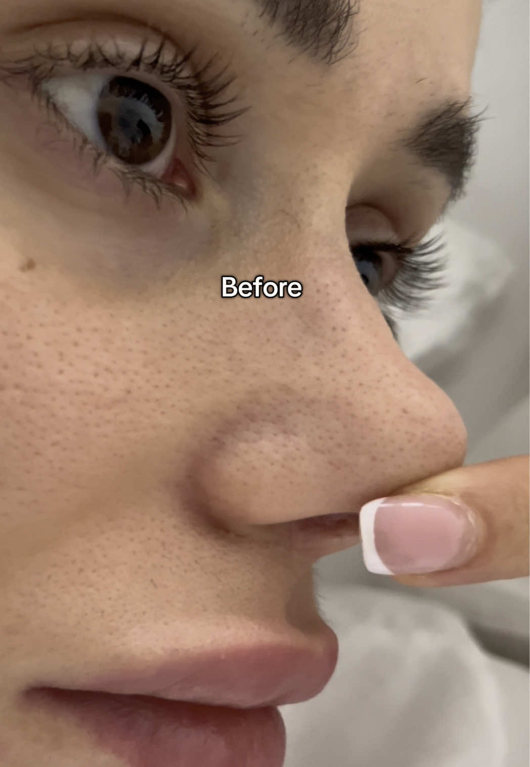 Any questions? 😌  #skincare #koreanskincare #pores #sebaceousfilament #blackhead #pore #cleanser #beauty 