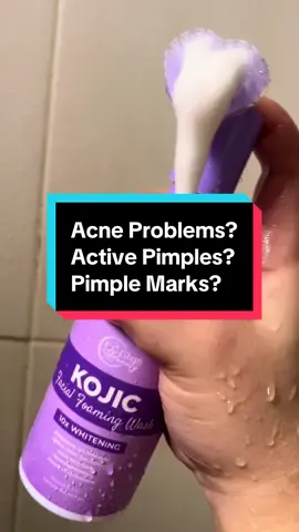 Acne Problems? Try Kojic Facial Foaming Wash by CC Glam and Beauty #fyp #kojic #kojicfacialfoamingwash #kojicacid #pimple #acne #acneproblems 
