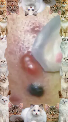 #lips #skincare #pimple #acne #cyst