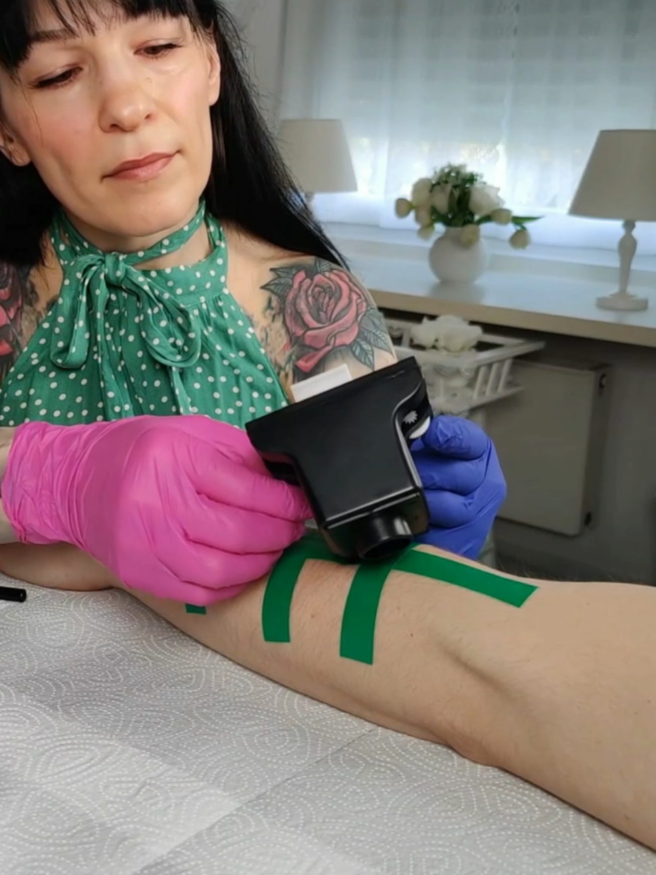 Unique skin allergy tests on the arm #asmr #asmrvideo 