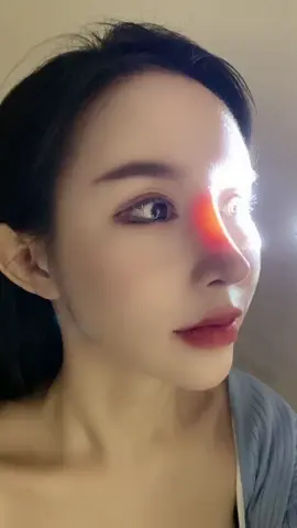 Silicone rhinoplasty complications硅胶隆鼻后遗症#隆鼻 