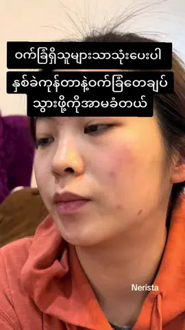#hcသလဲသီးမျက်နှာသစ်ဆပ်ပြာ #ပစ္စည်းစစ်စစ်သာရောင်းချသည် #ဝက်ခြံပြသနာရှိသူတိုင်းကြည့်ပေးပါ #ဝက်ခြံကြောင်းစိတ်ညစ်နေသူများအတွက် #hcproductmyanmar #facesoap #tiktokmarketplace #10millionviews #Khaingzar #soap 