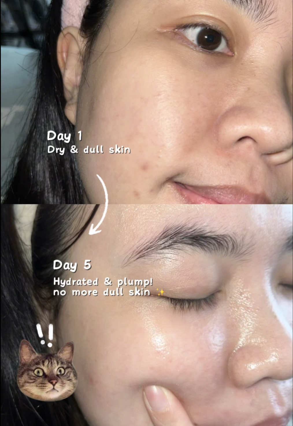 Just 5 days and my skin is already transformed! Even during fasting, my skin stays bouncy & glowing ✨ Try this challenge with me now! 💖 @medicube Malaysia  #Medicube #Medicubemalaysia #Medicubemy #PDRNOneDaySerum #5daysglowupchallenge #5dayschallenge #Glowupin5days #BrighteningGlow #PDRNserum #ViralSkincare #skincareviral 