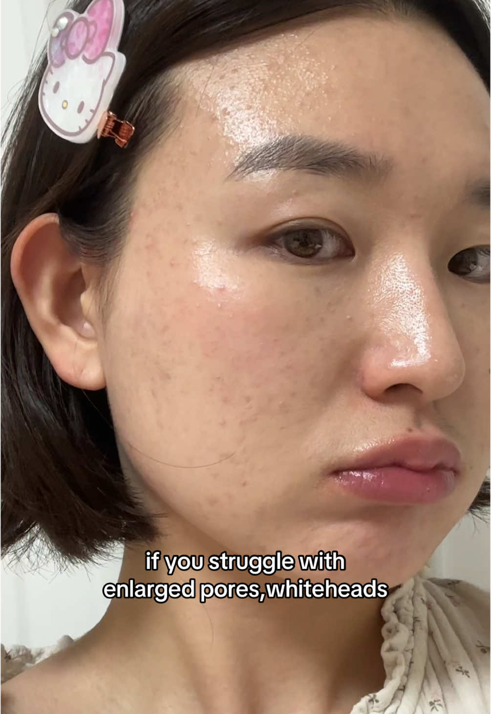 game changer for clogged pores🌟 #oganacell #walnutcleanser #derxcleanser  #largepores #skincaretips #bloomkare @Bloomkare @Oganacell Dermatology Clinic  