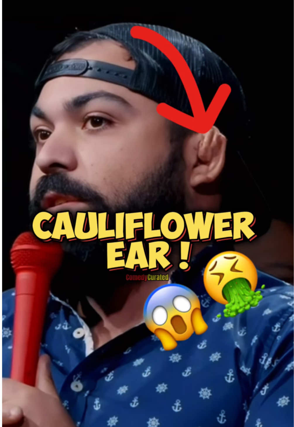 Insane Cauliflower Ear😱🤣 Comedian : @Wvsherman  KT Episode : 710 #killtonypodcast #standupcomedy #standup #funny #comedy #comedycurated #tonyhinchcliffe #kampatterson #tylerfischer #fypシ゚viral 