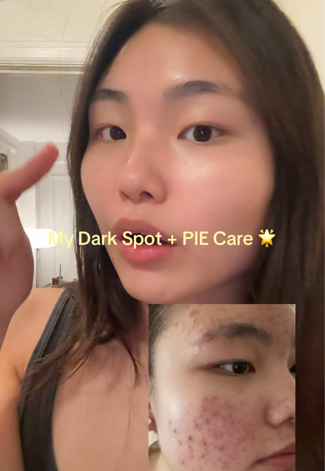 the perfect trio for pie & dark spots 🍢 @AXIS-Y @skinsquared #skinsquared #costconext #AXISY #axisypartner #axisy #skincare #koreanskincare #kbeauty #SelfCare #hyperpigmentation #darkspots #pie 