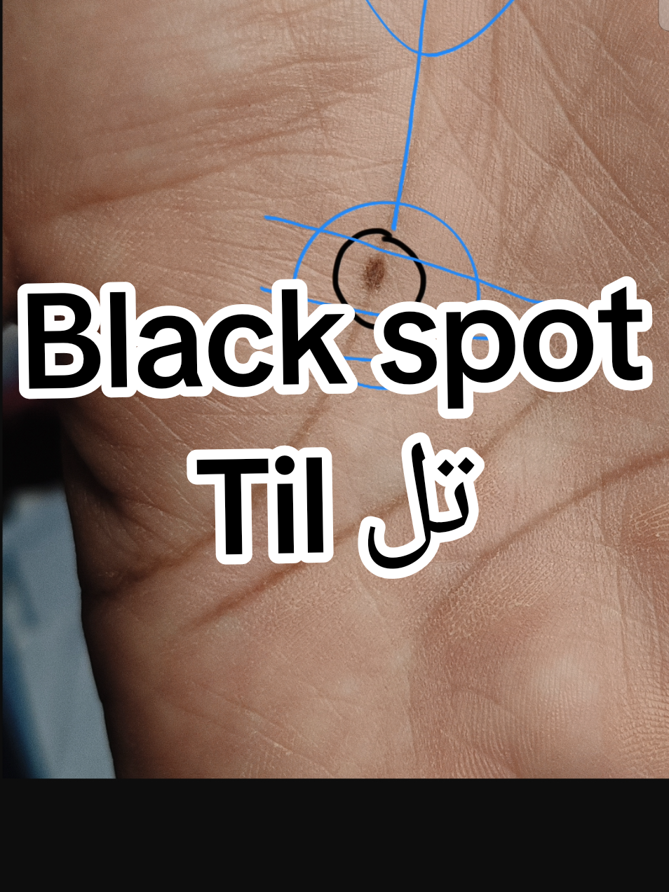Til Black spot on life line in hand #yousafpalmist #palmistry001 #palmistry #handreading #palmist #til #black #spot 