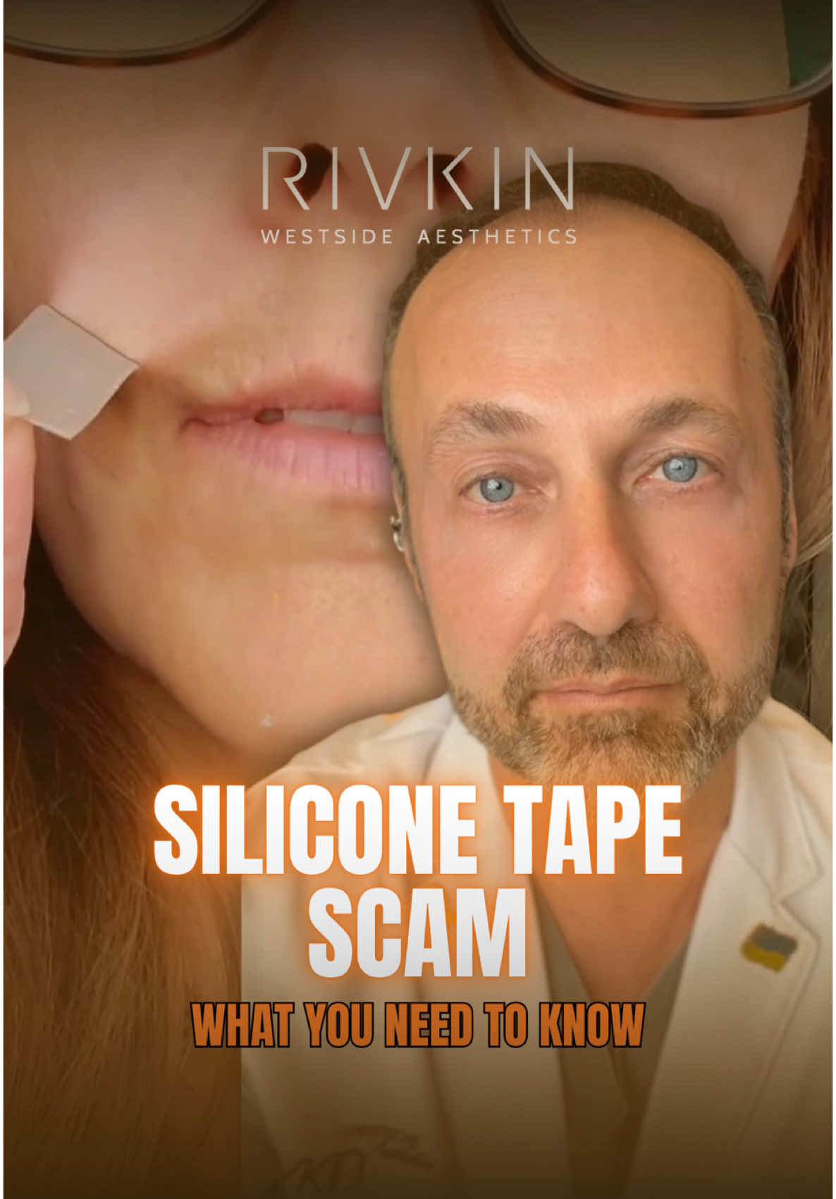 Here we go again… 🙃 Let’s talk about silicone tape and what it actually does. I’ve been seeing a lot of posts claiming that silicone tape can reduce wrinkles like crow’s feet and nasolabial folds. Unfortunately, that’s just not true. 🚫 Silicone tape is designed for scar prevention and healing—not for smoothing out wrinkles. 🩹 It hydrates the skin, protects it from UV damage ☀️, and helps redistribute tension to prevent scars from forming. It also modulates collagen production to keep excessive scar tissue from developing. That’s its real function. Now, if you apply silicone tape over a wrinkle overnight, sure, your skin might look temporarily plumper and more hydrated in the morning. But that effect is short-lived… Your skin will return to its natural state over time. It’s not a long-term solution for wrinkles, despite what influencers might claim. 🙄 At the end of the day, if someone is selling this as an anti-wrinkle fix, they’re making money 💰—but it’s not helping you. Just keeping it real! #siliconetape #facetape #mythbusting #expertinjector #aestheticstrends #drrivkin #rivkinaesthetics
