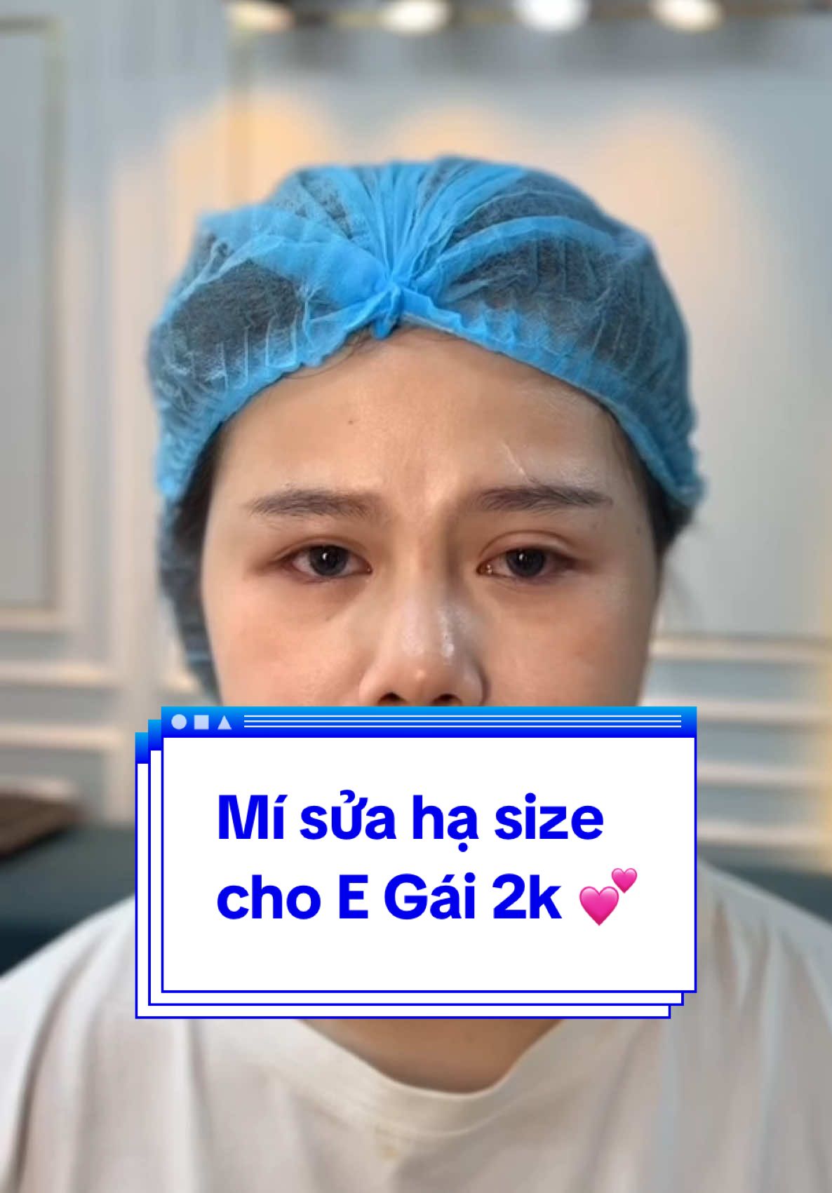 Sửa mí lệch , nhược cơ nâng mi nhẹ cho E Gái 2k    Mí hư nhìn khuôn mặt E buồn thật sự ,giờ thì ổn rồi . Chúc mừng E Gái lấy lại thanh xuân nhaa 💕💕      #Tuyết_Diamond #làmđẹptựnhiên #MÍ_Xinh #Sửa_mí_hạ_size#xuhuong #videoviralitiktok #Mí_đẹp 
