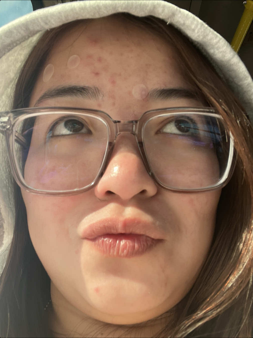 As an acne girly, I’m always curious how my face/skin looks🥹 Really lessen my confidence to upload my selfies. Clear skin balik ka na, pls! Any tips/recommendations? #CapCut #viraltiktok #acneproneskin #skintok 