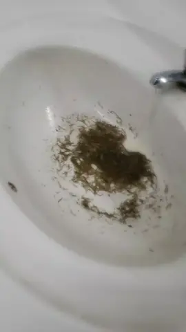 مؤخرة متسخة  #viral#paratii #caca #paratii #paratiiiiiiiiiiiiiiiiiiiiiiiiiiiiiii #fyp#pasto #baño #skibiditoilet 